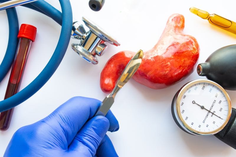 Weight Loss Surgery