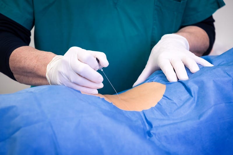 Spinal Decompression