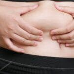 Tummy Tuck (Abdominoplasty): Types, Recovery, Risks and Results