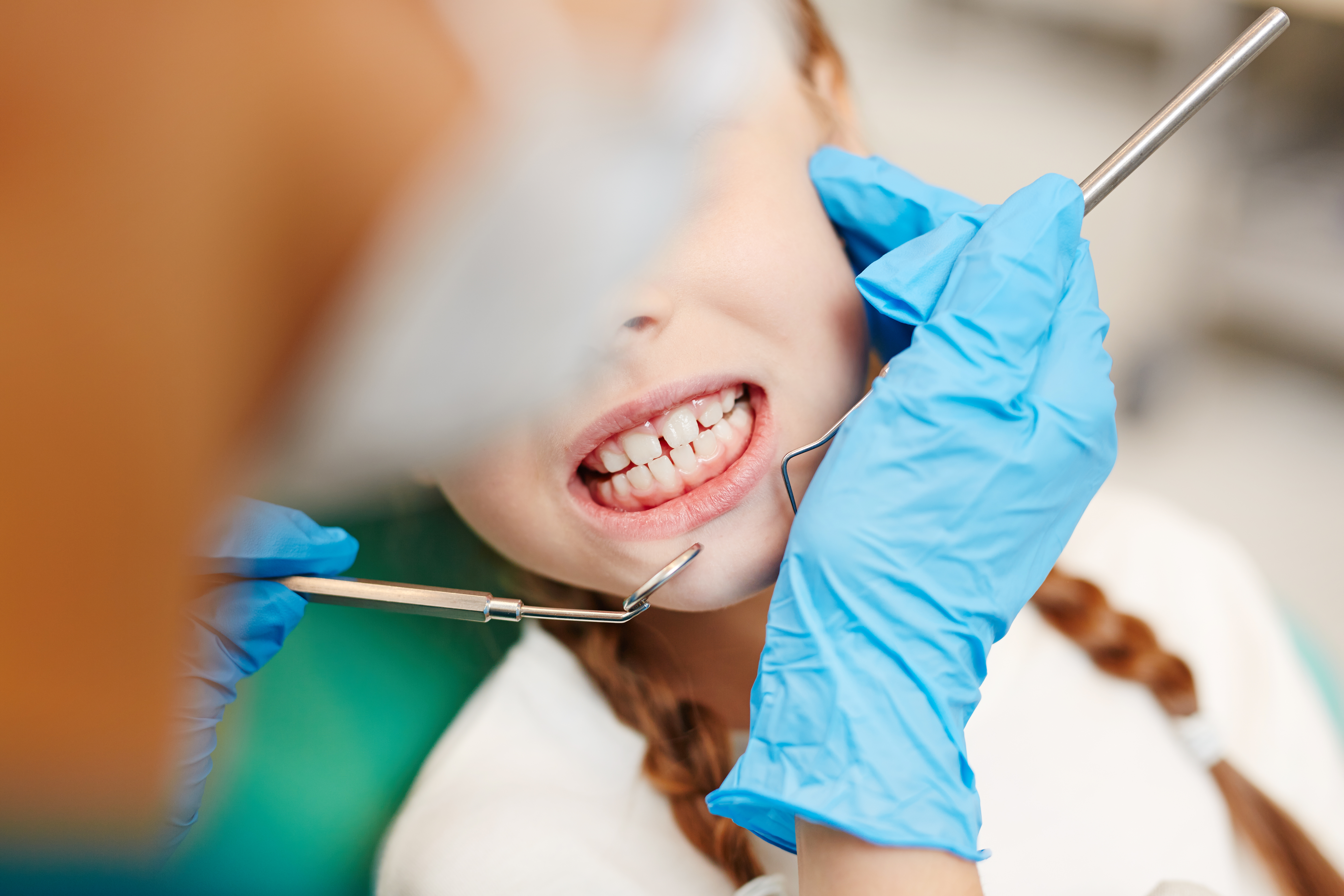 Close view of a patient's teeth being checked for the cause of toothache