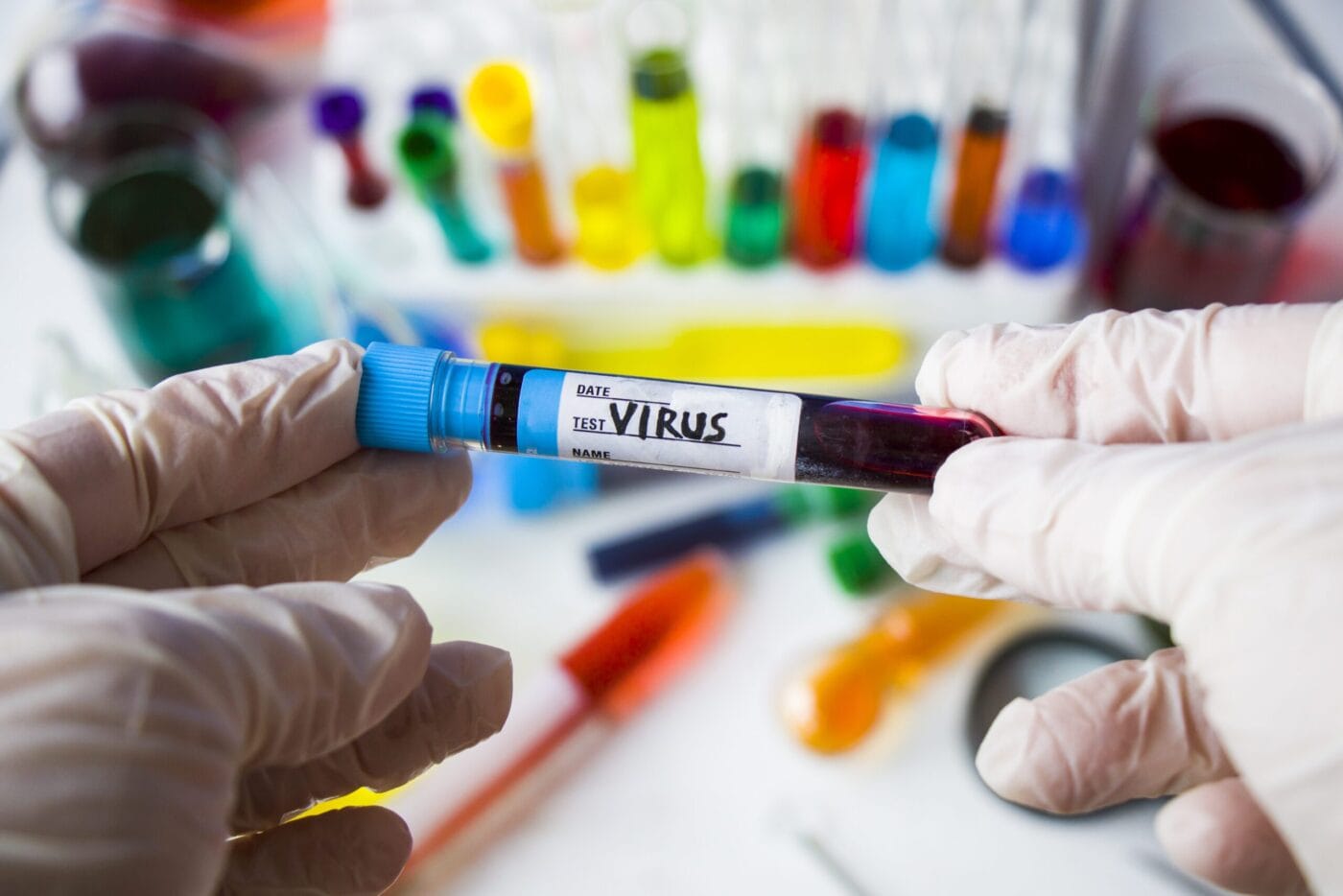 Diagnosing Nipah Virus