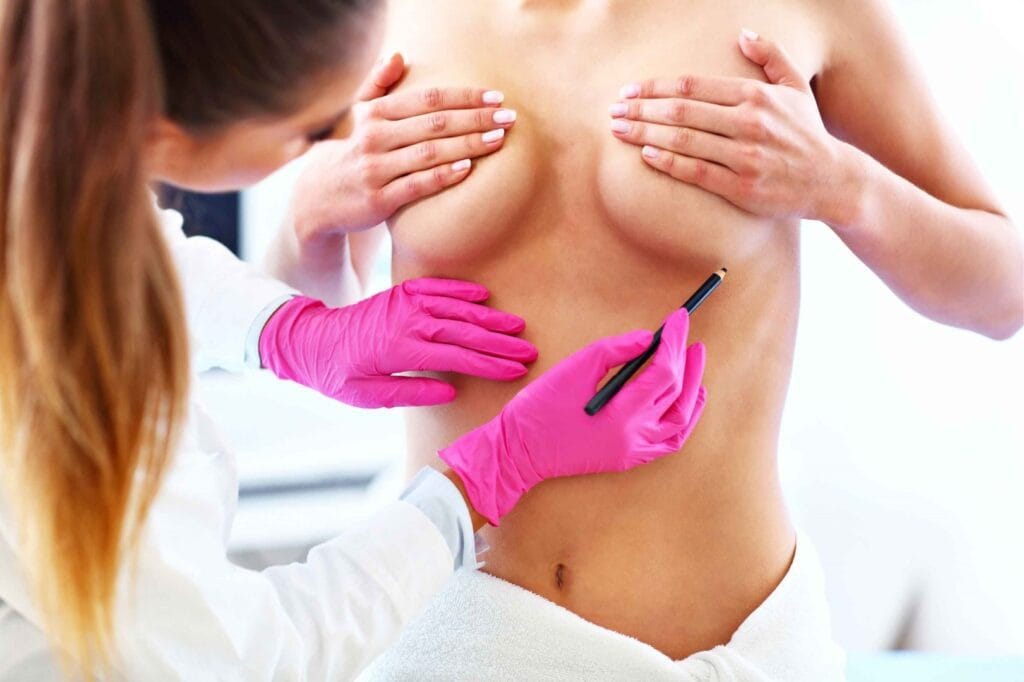 Breast Lift