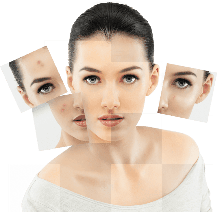 How to Get Rid of a Pimple Fast: What Works and What Makes It Worse