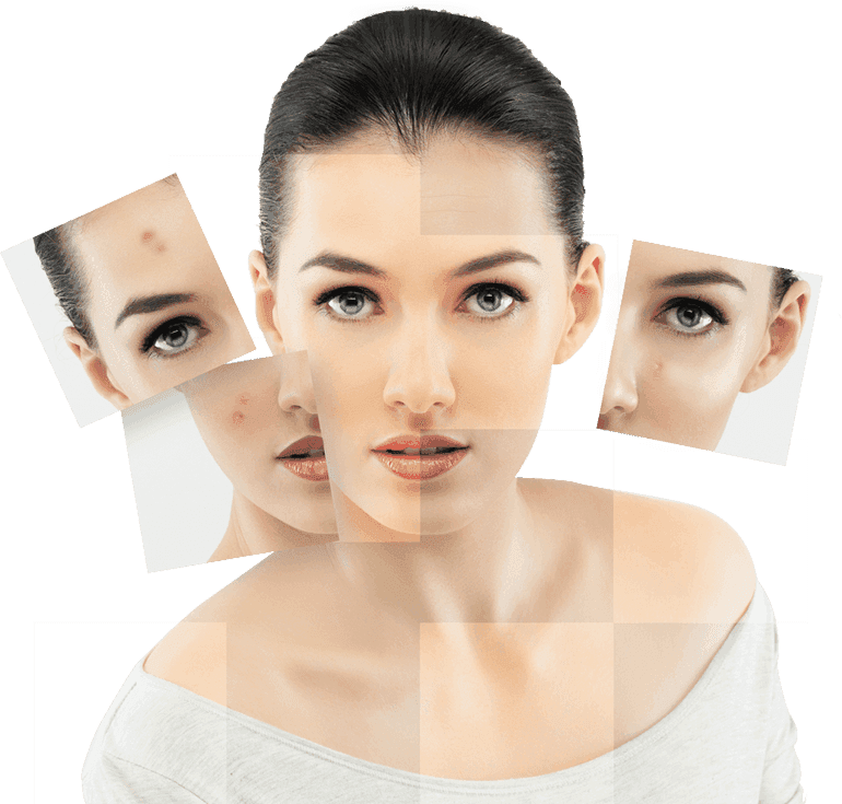 How to remove pimples overnight, Remedies & precautions