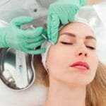 Botox injections