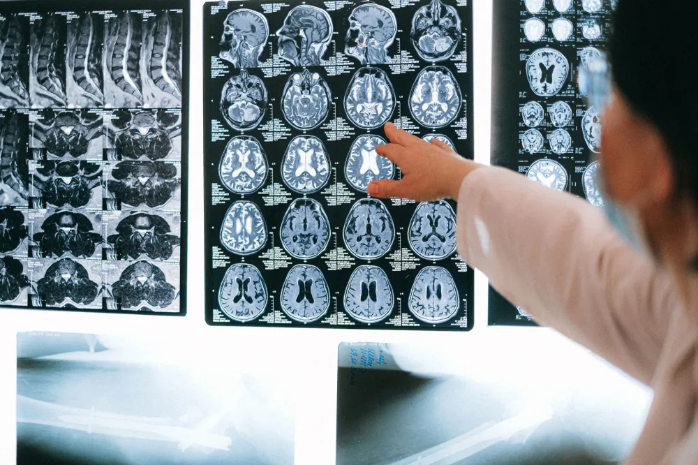 Brain scan image illustrating neuroscience research on meditation and stress