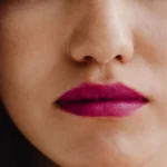 Fordyce Spots vs Pimples on the Lip: How to Tell