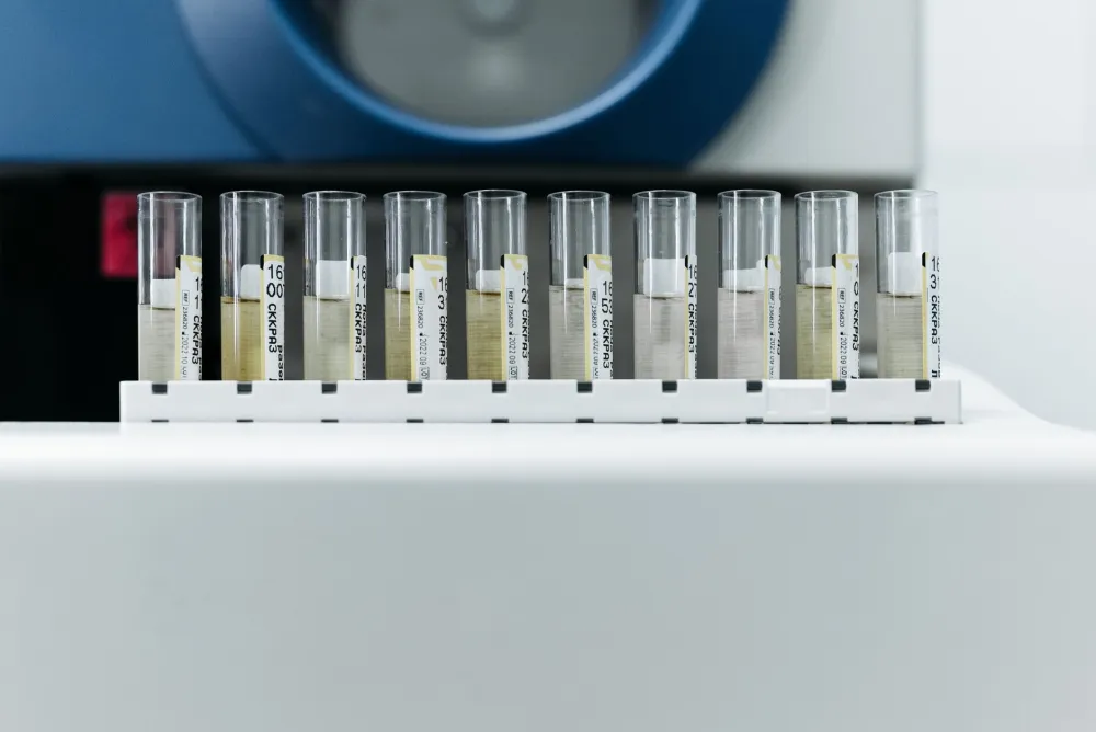 Laboratory sample tubes used to check genital bumps for common sexually transmitted infections