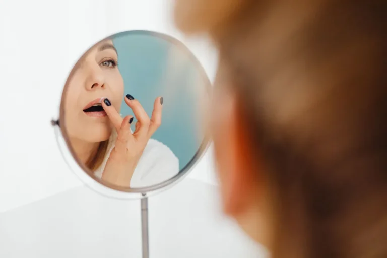 Pimple vs Cold Sore: 7 Simple Clues to Tell Them Apart