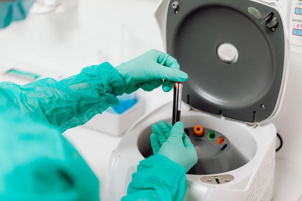 PRP Breast Lift: What It Is, Honest Results and Risks 2 Blood sample tubes in a lab centrifuge, the first step of a PRP breast lift