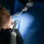 Toxicants in Children’s Teeth & Autism: What Research Shows
